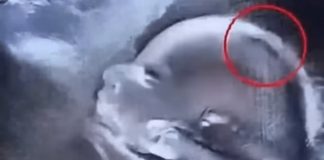 „Beba rođena s gustom kosom oduševila bolnicu – i celu zajednicu“ - featured image