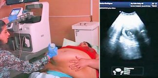Trudna žena ima 226 kilograma i došla je na ultrazvuk, a onda je medicinska sestra podigla njen stomak i pogledala bolje… (VIDEO) - featured image
