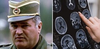 Sve bolesti od kojih je bolovao Ratko Mladić: Ovi simptomi ne smeju da se ignorišu, mogu biti kobni - featured image