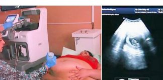 Trudna žena ima 226 kilograma i došla je na ultrazvuk, a onda je medicinska sestra podigla njen stomak i pogledala bolje… (VIDEO) - featured image