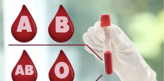 Najnovija otkrića medicine! Krvna grupa utiče na rizik od raka: Ko su potencijalne žrtve raka želuca i kolorektalnog karcinoma - featured image