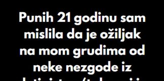 “Punih 21 godinu sam mislila da je ožiljak na mom grudima od neke nezgode iz detinjstva…” - featured image