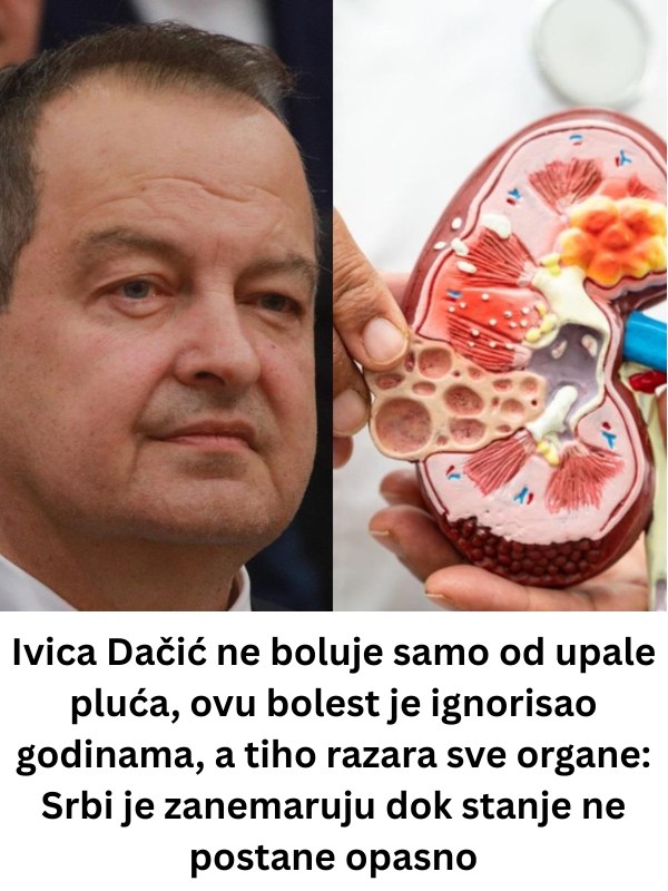 lvica Dačić ne boluje samo od upale pluća, ovu bolest je ignorisao godinama: SVl je zanemaruju dok stanje ne postane opasno - featured image lvica Dačić ne boluje samo od upale pluća, ovu bolest je ignorisao godinama: SVl je zanemaruju dok stanje ne postane opasno - featured image