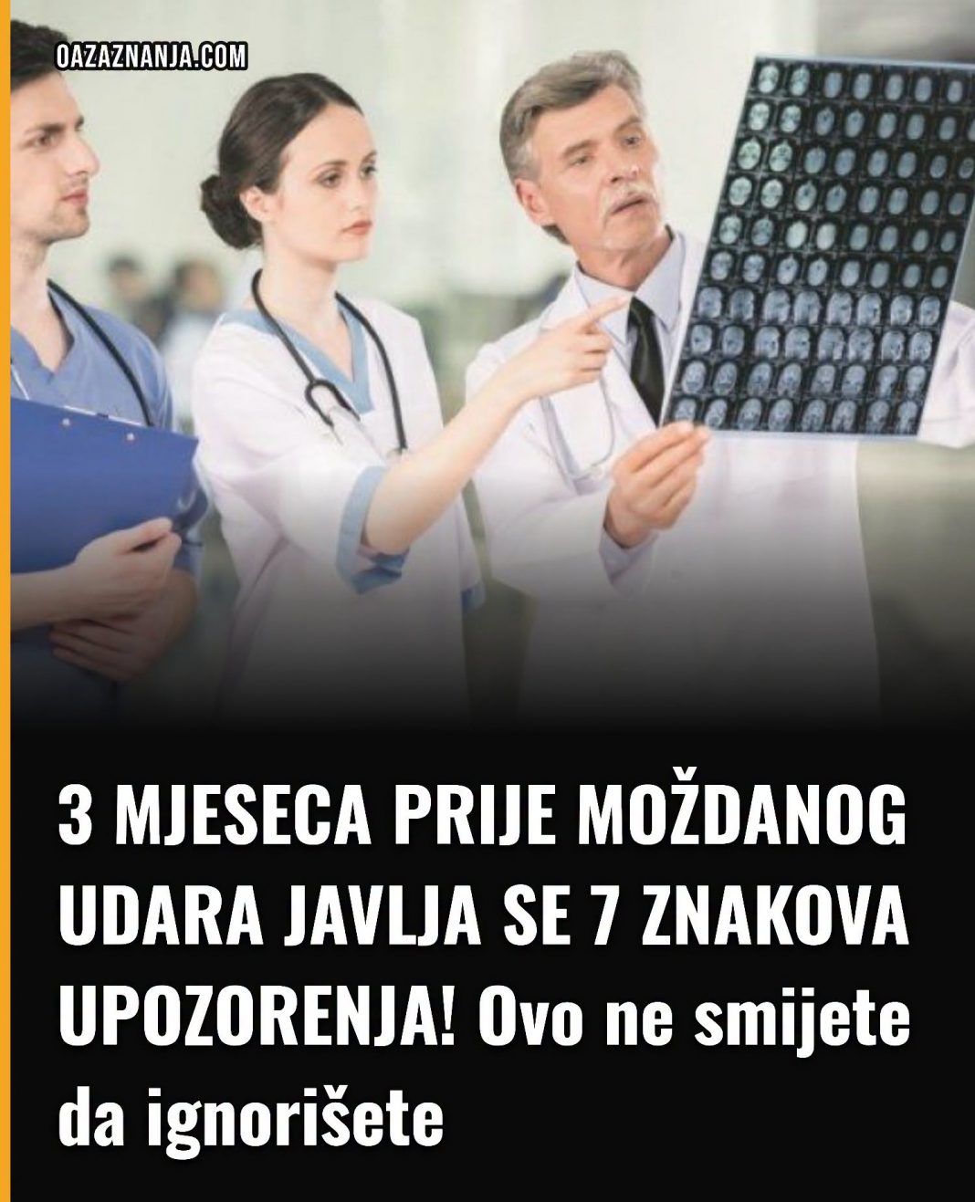 3 MJESECA PRIJE MOŽDANOG UDARA JAVLJA SE 7 ZNAKOVA UPOZORENJA! Ovo ne smijete da ignorišete - featured image