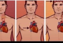 1 ZNAK NA KOŽI UKAZUJE DA JE VAŠE SRCE U LOŠEM STANJU: Ako ovo primijetite javite se doktoru ODMAH! 1 ZNAK NA KOŽI UKAZUJE DA JE VAŠE SRCE U LOŠEM STANJU: Ako ovo primijetite javite se doktoru ODMAH! - featured image